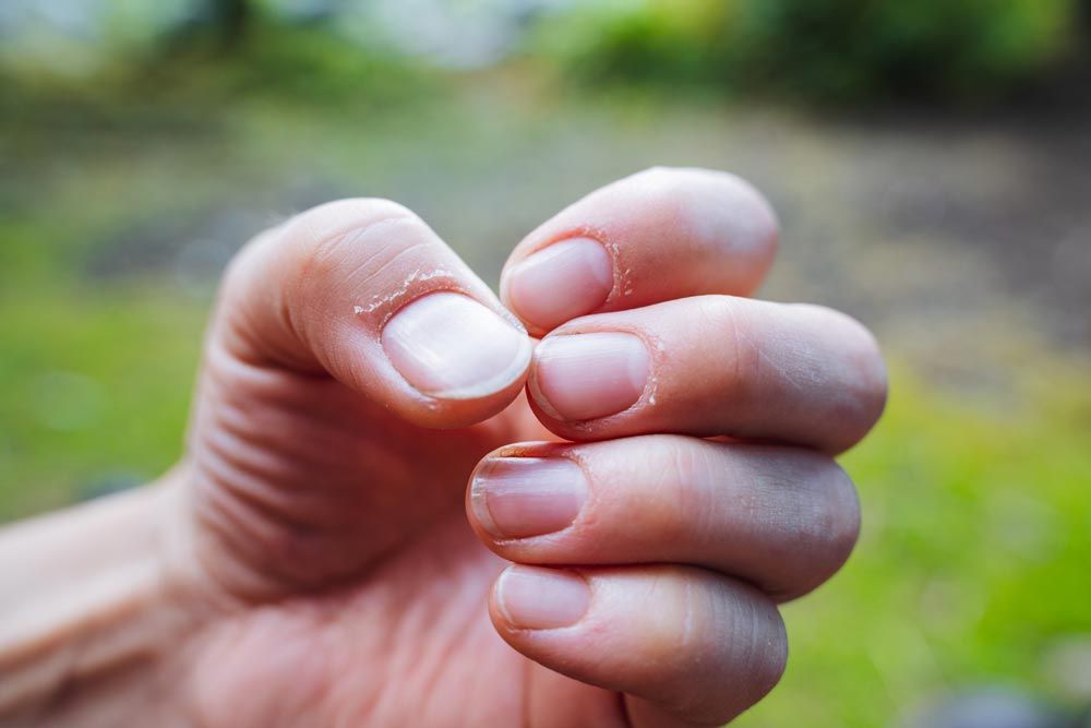 cuidado de la piel y uñas en verano